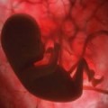 Comunicado ante el aborto en hospitales públicos y privados de Cataluña (España)