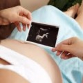 Silencio mediático ante el aborto